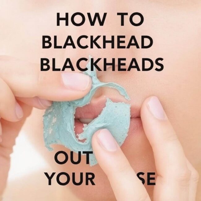 Usuwanie wągrów z nosa